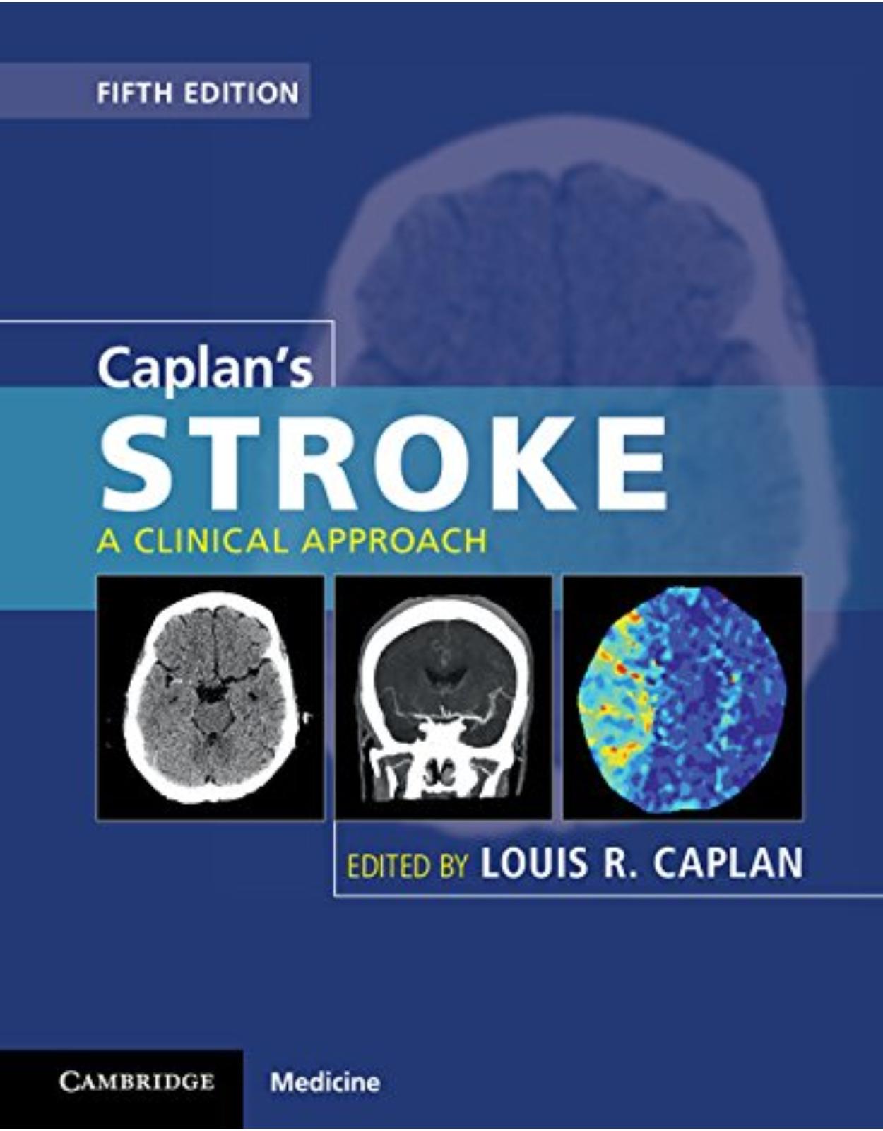 Caplan’s Stroke: A Clinical Approach