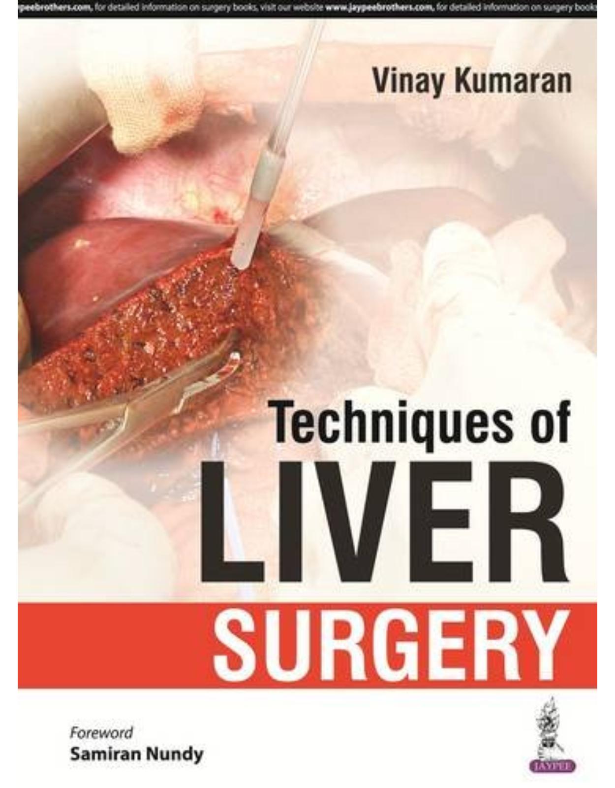 Techniques of Liver Surgery