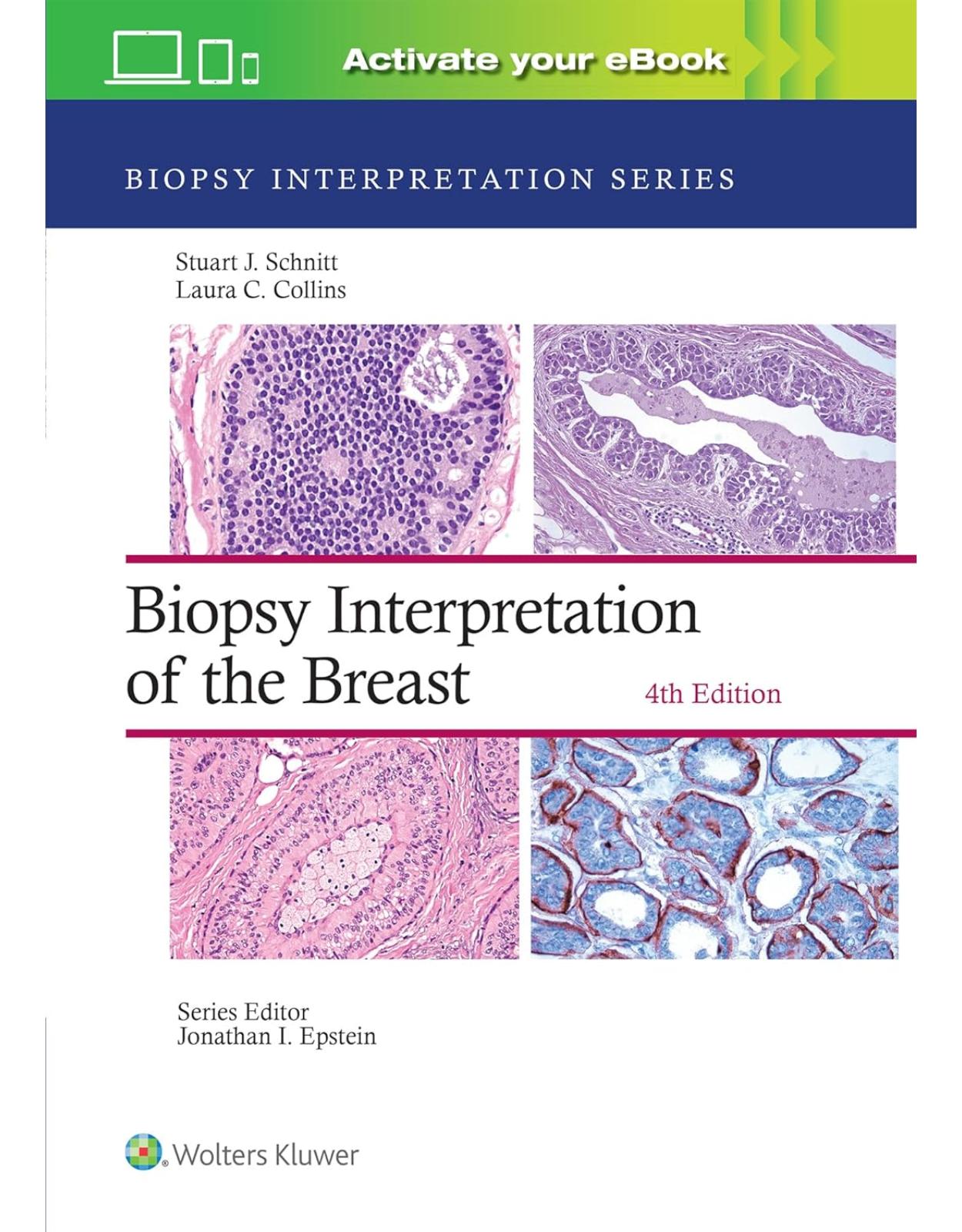 Biopsy Interpretation of the Breast: Print + eBook with Multimedia. Fourth edition