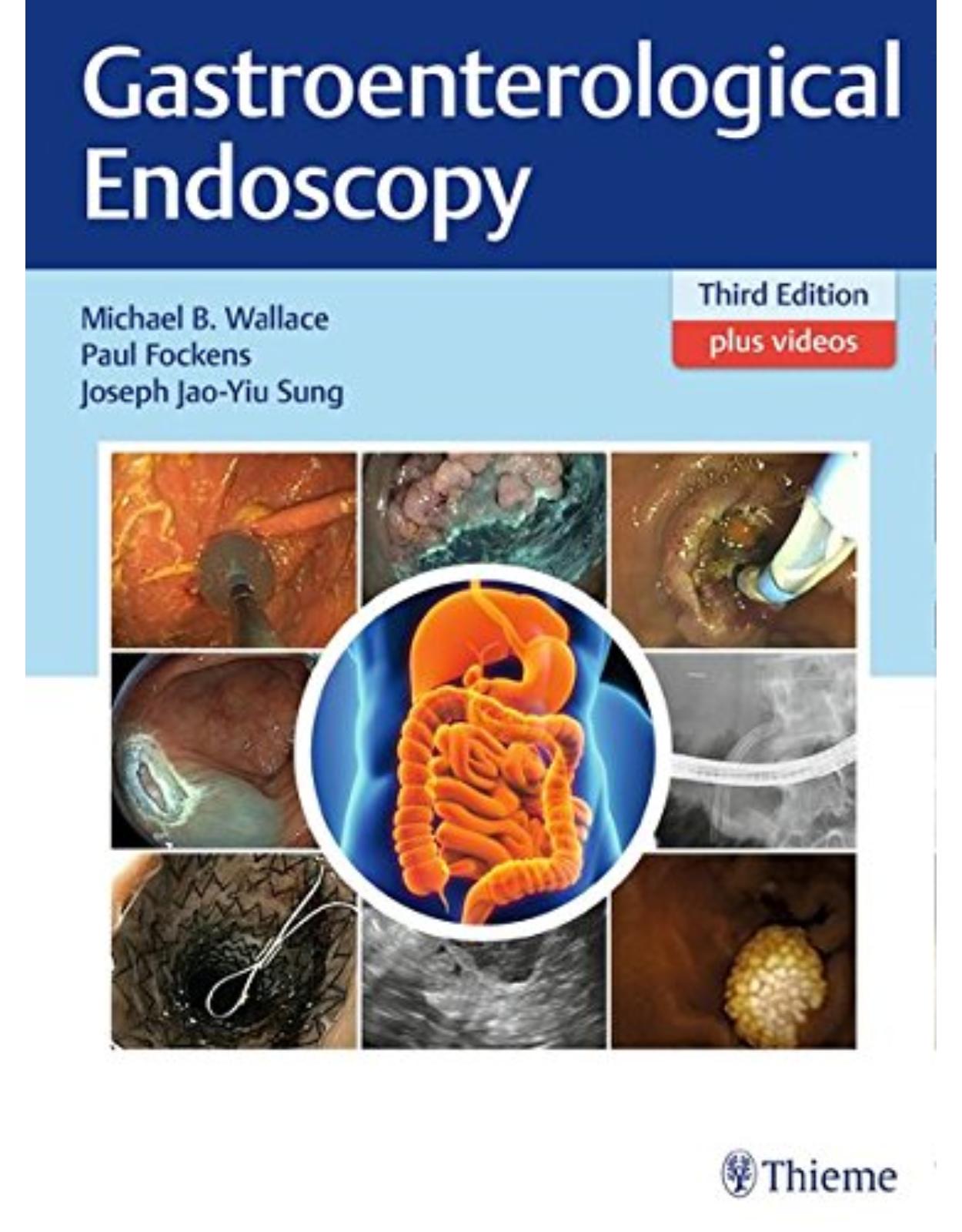 Gastroenterological Endoscopy