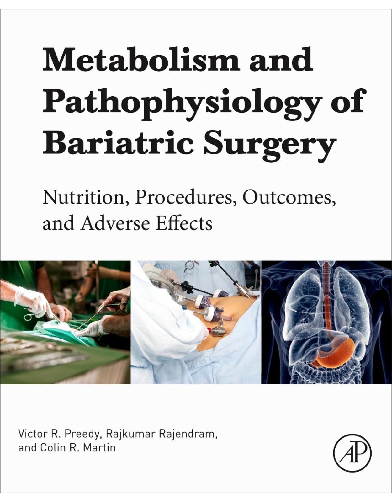 Metabolism and Pathophysiology of Bariatric Surgery: Nutrition Procedures, Outcomes and Adverse Effects