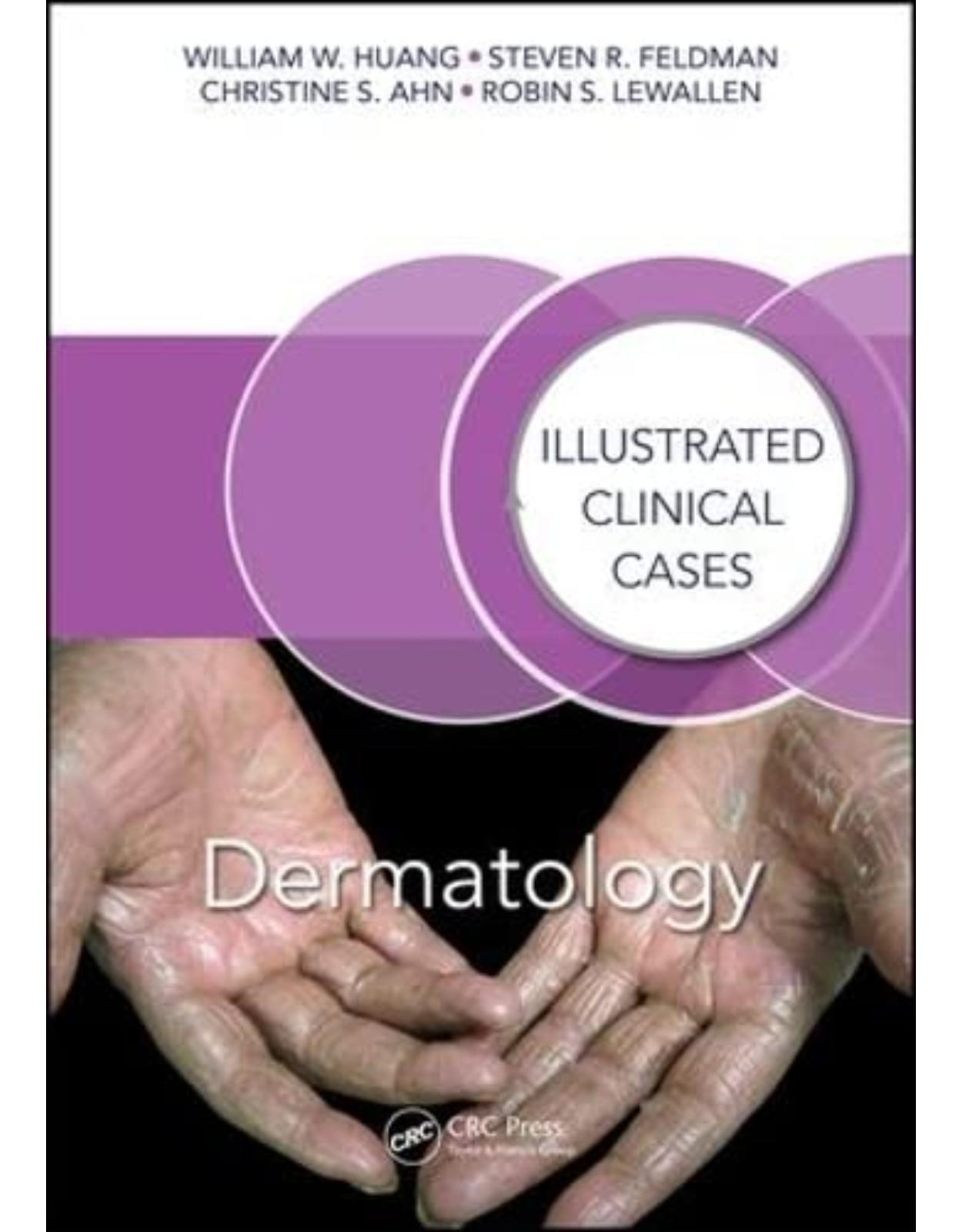 Dermatology: Illustrated Clinical Cases 