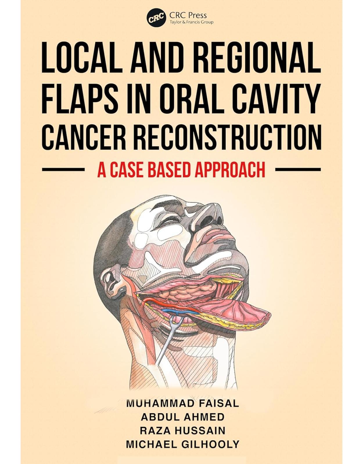 Local and Regional Flaps in Oral Cavity Cancer Reconstruction. A case-based approach