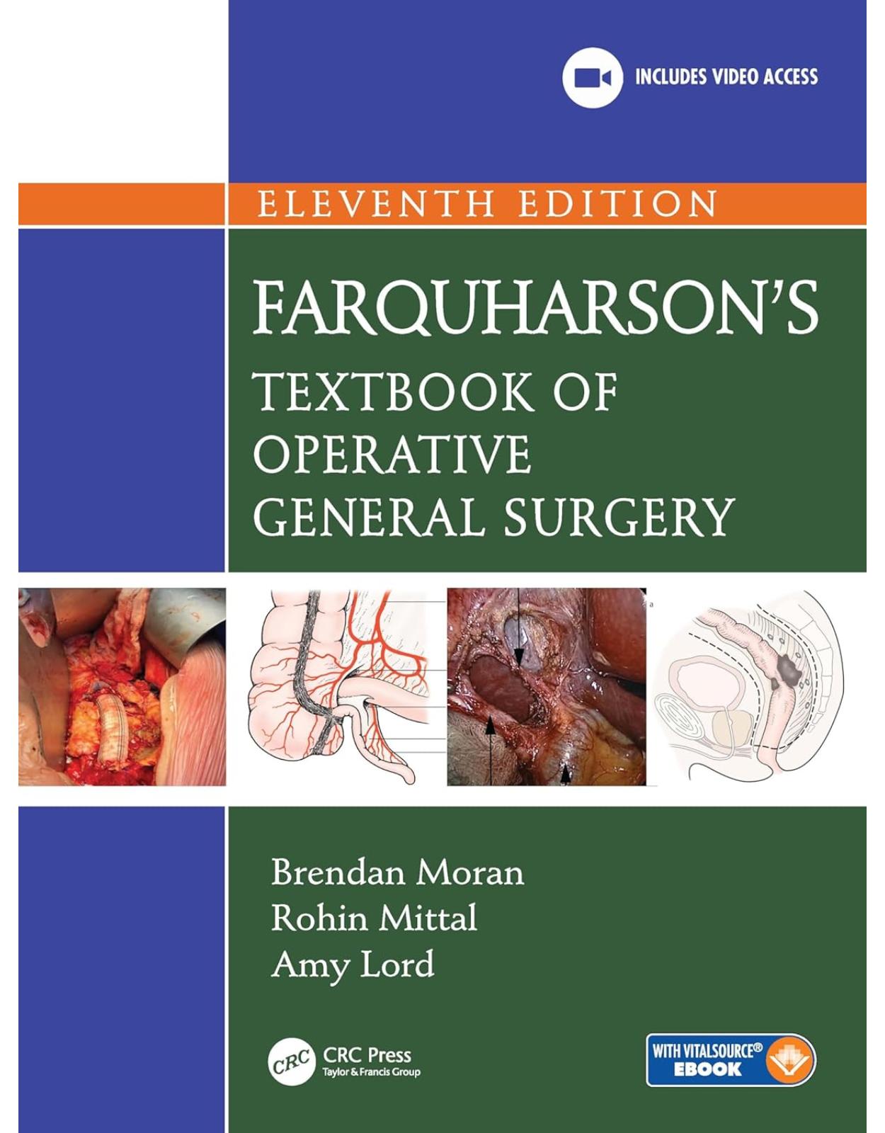 Farquharson's Textbook of Operative General Surgery
