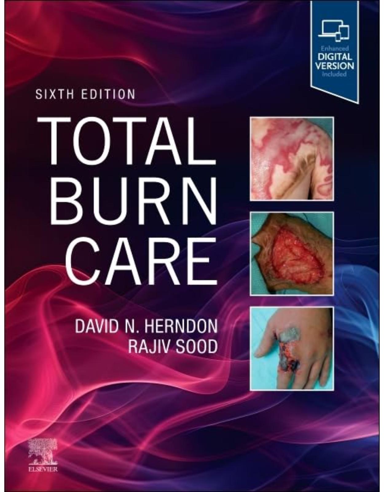 Total Burn Care, 6th Edition