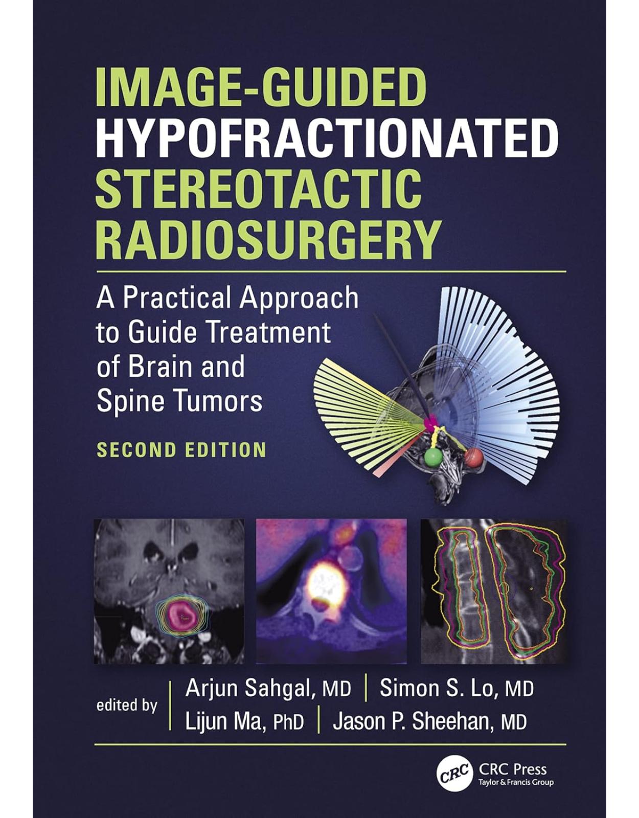 Image-Guided Hypofractionated Stereotactic Radiosurgery. A Practical Approach to Guide Treatment of Brain and Spine Tumors