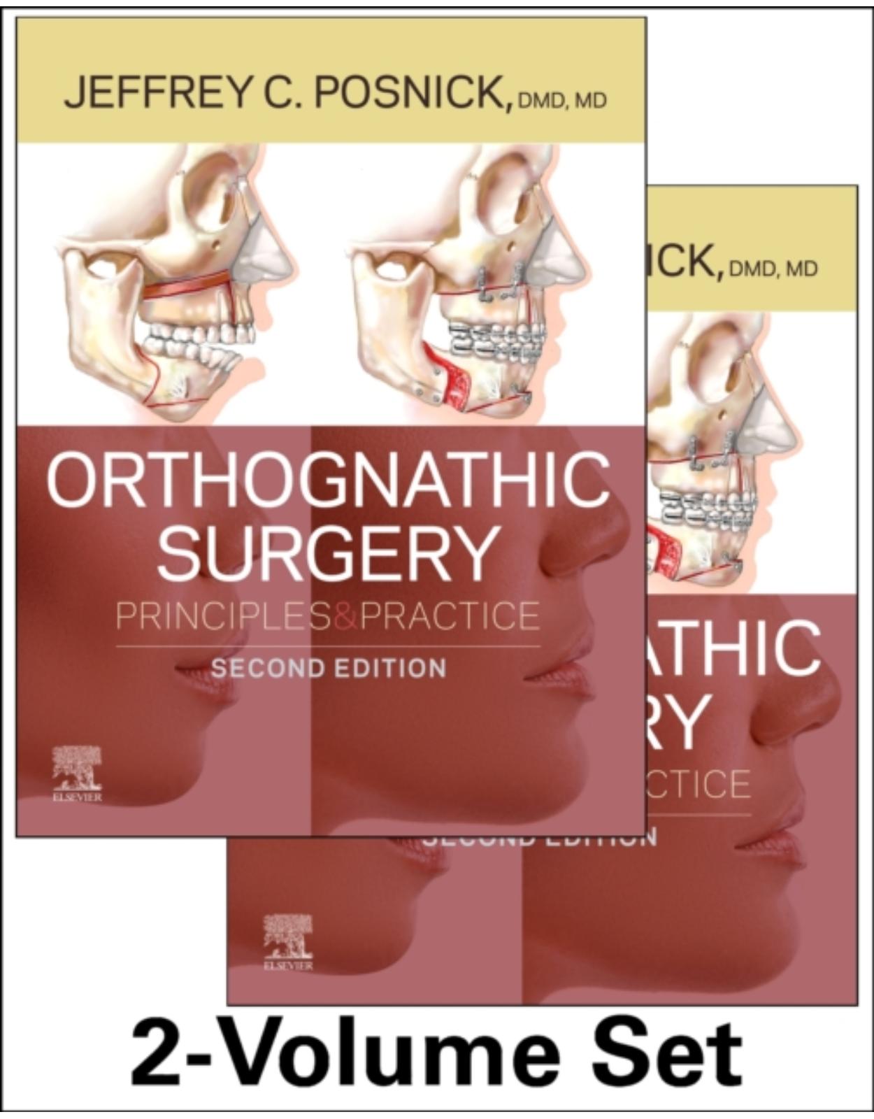 Orthognathic Surgery - 2 Volume Set: Principles and Practice