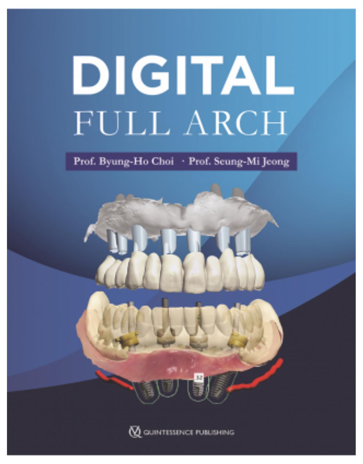 Digital Full Arch