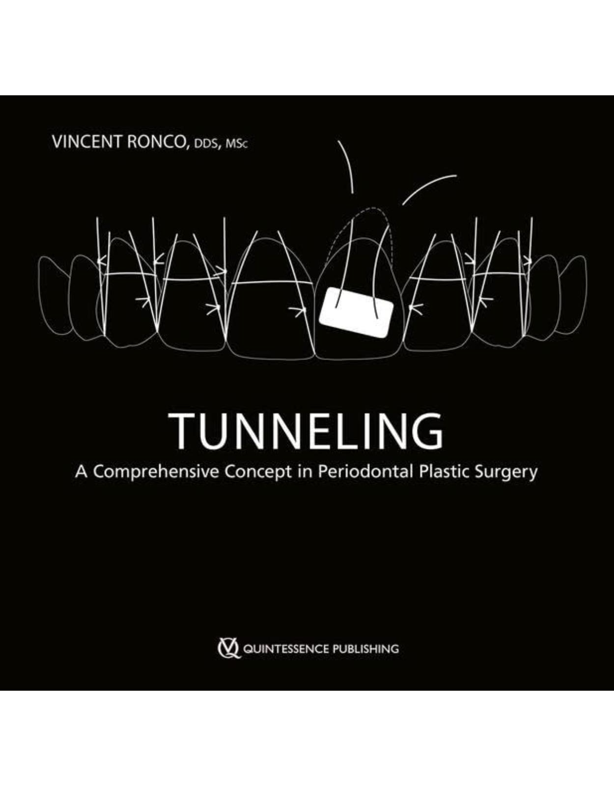 Tunneling