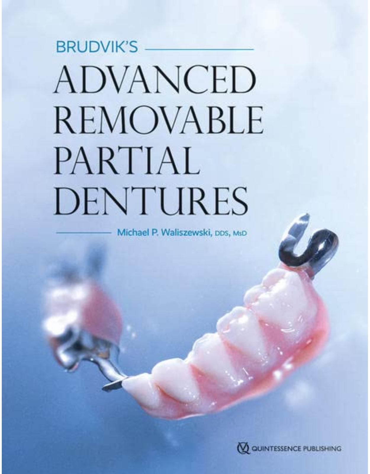 Brudvik’s Advanced Removable Partial Dentures