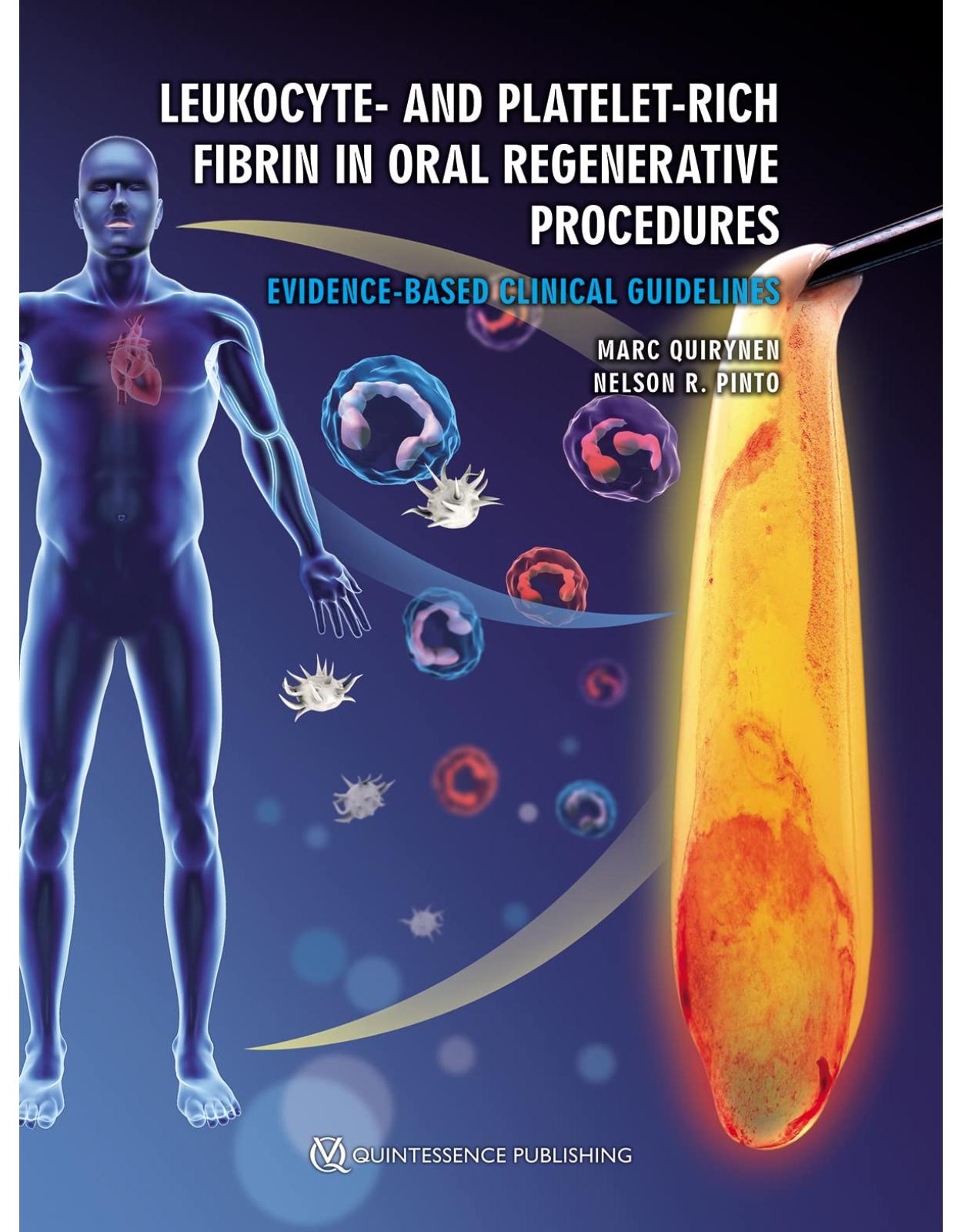 Leukocyte- and Platelet-Rich Fibrin in Oral Regenerative Procedures