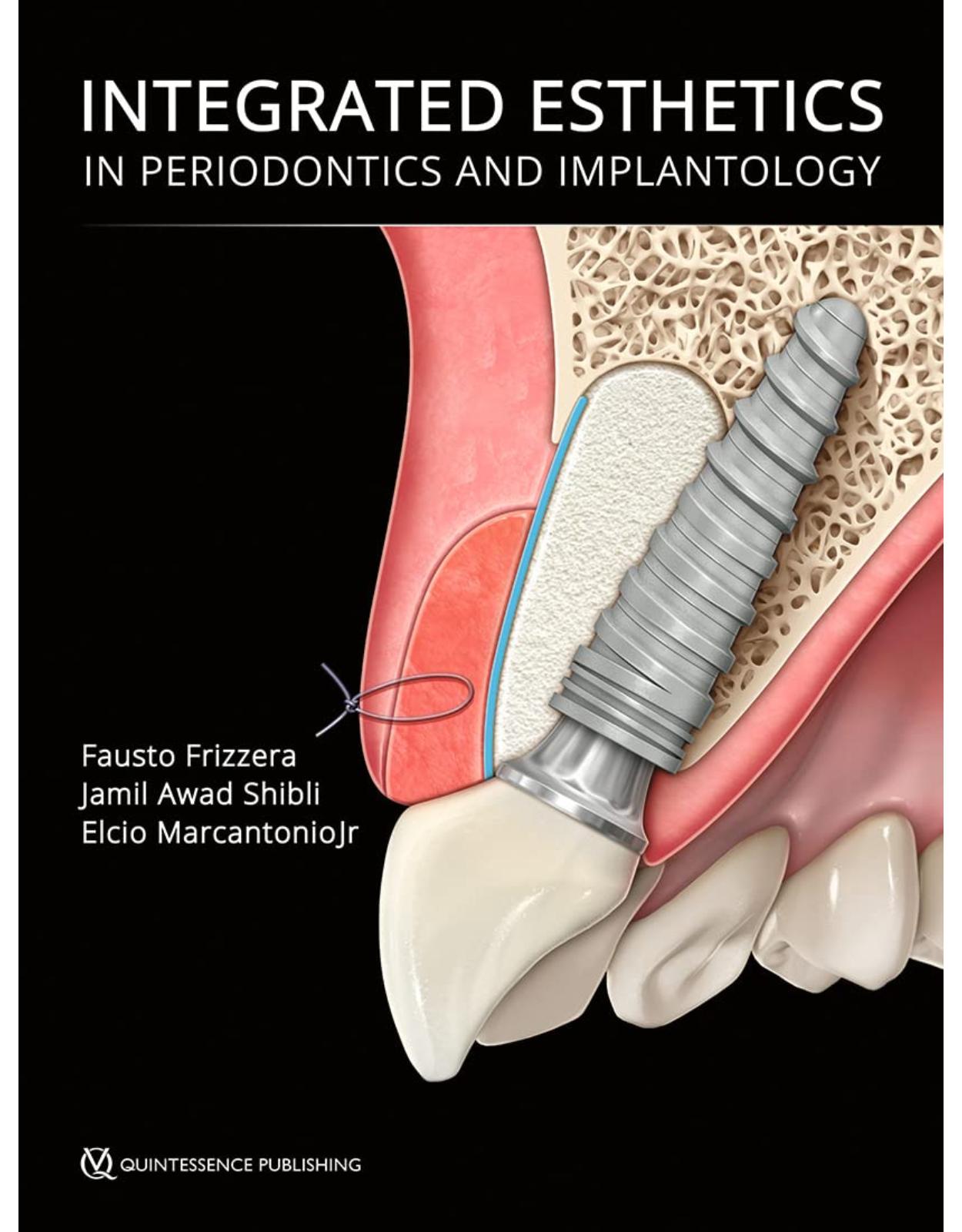 Integrated Esthetics in Periodontics and Implantology