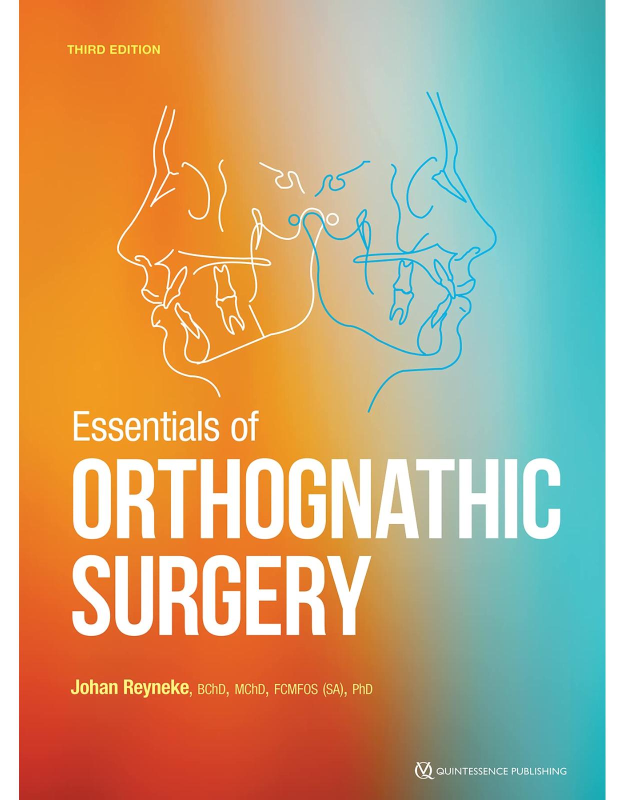 Essentials of Orthognathic Surgery