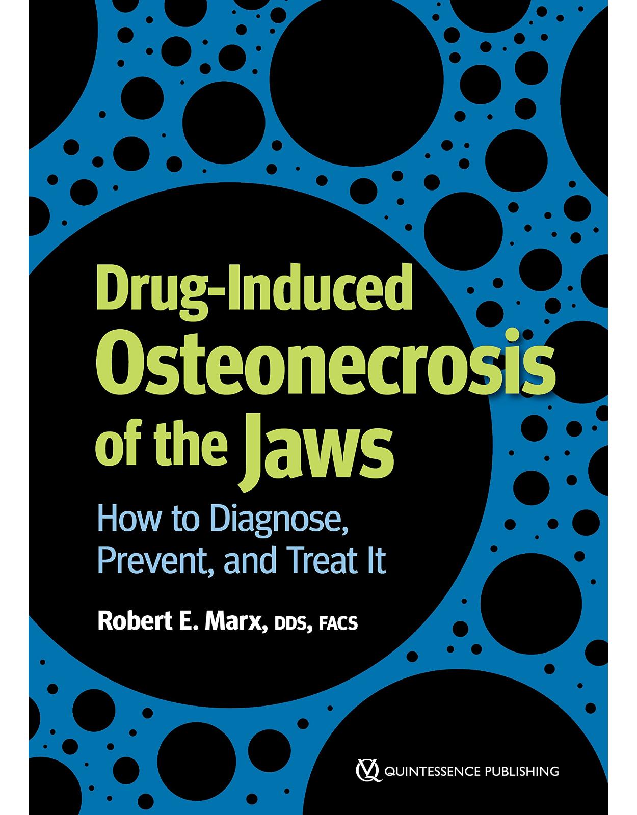 Drug-Induced Osteonecrosis of the Jaws: How to Diagnose, Prevent, and Treat It
