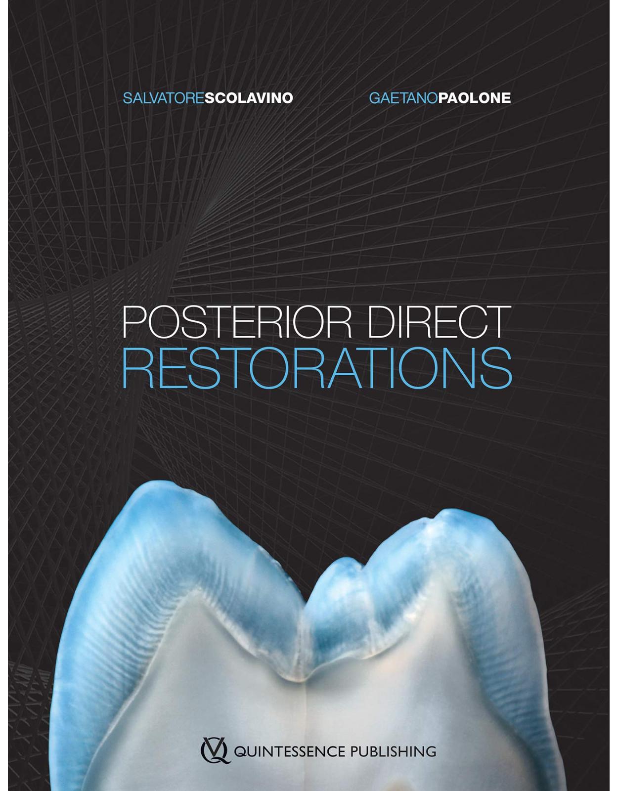 Posterior Direct Restorations