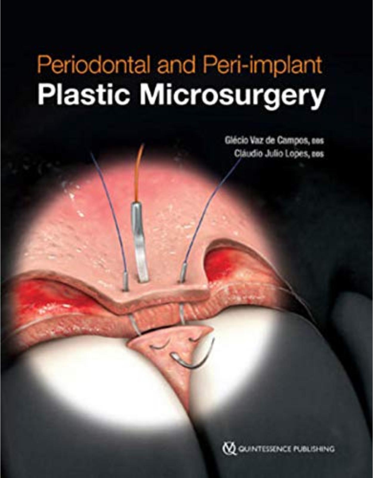 Periodontal and Peri-implant Plastic Microsurgery