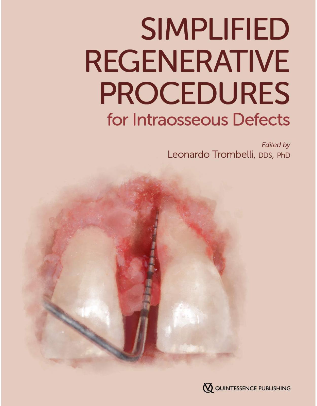 Simplified Regenerative Procedures for Intraosseous Defects