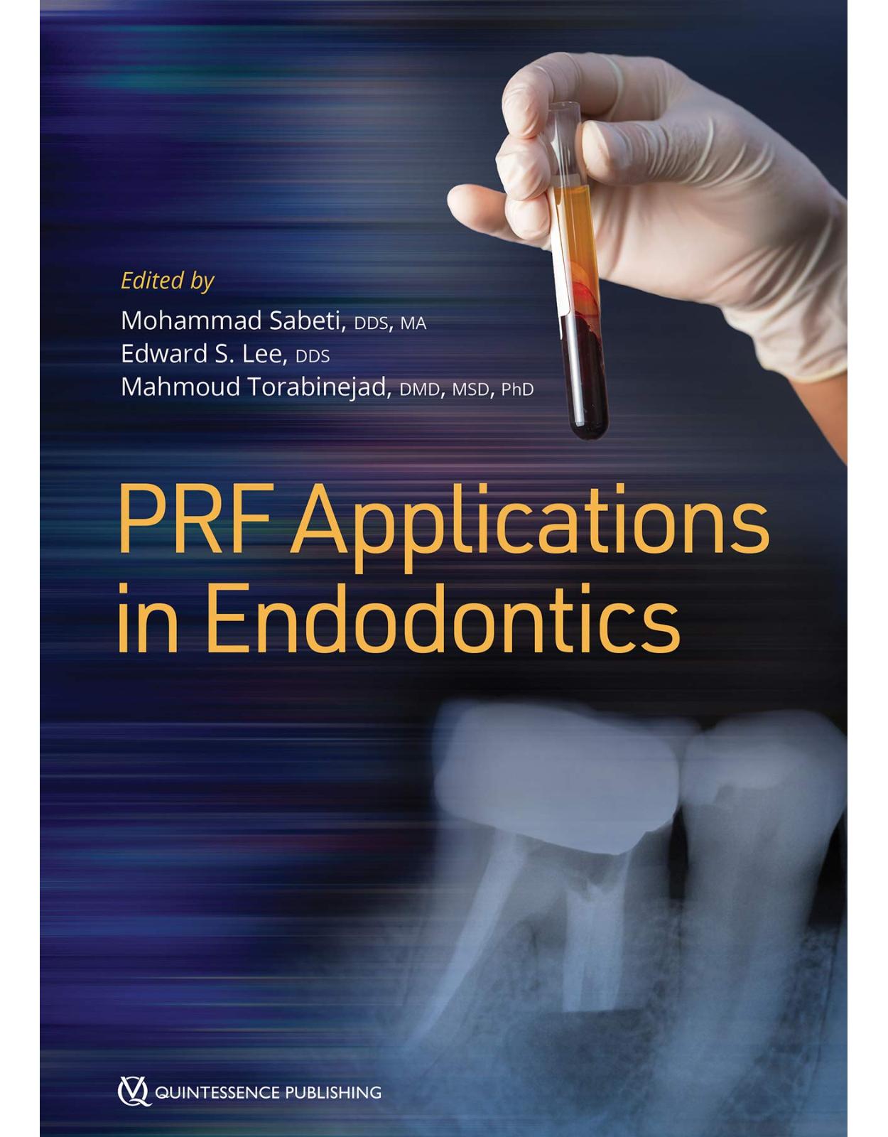 PRF Applications in Endodontics