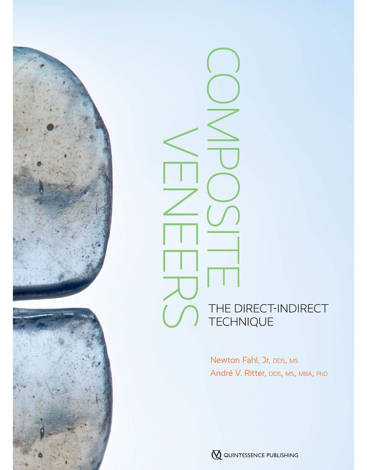 Composite Veneers: The Direct-Indirect Technique
