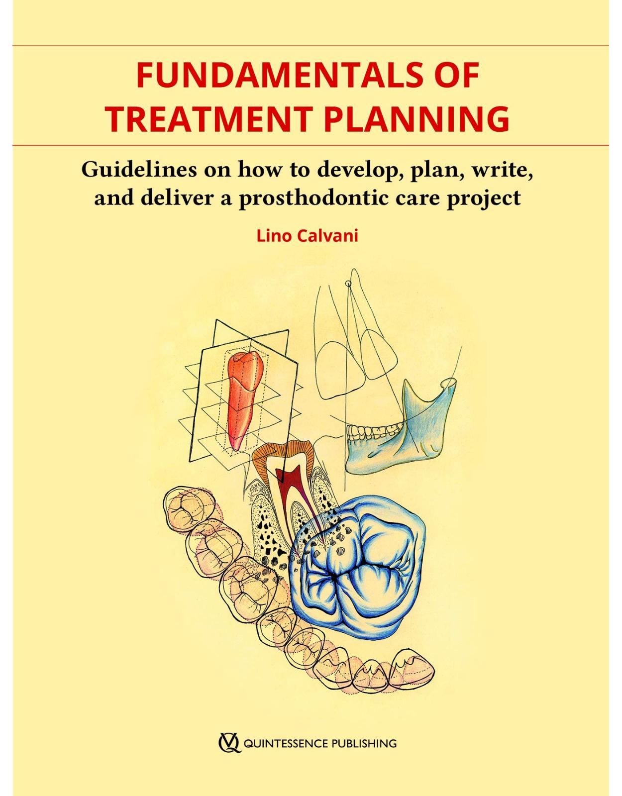 Fundamentals of Treatment Planning: Guidelines on How to Develop, Plan, Write, and Deliver a Prosthodontic Care Project
