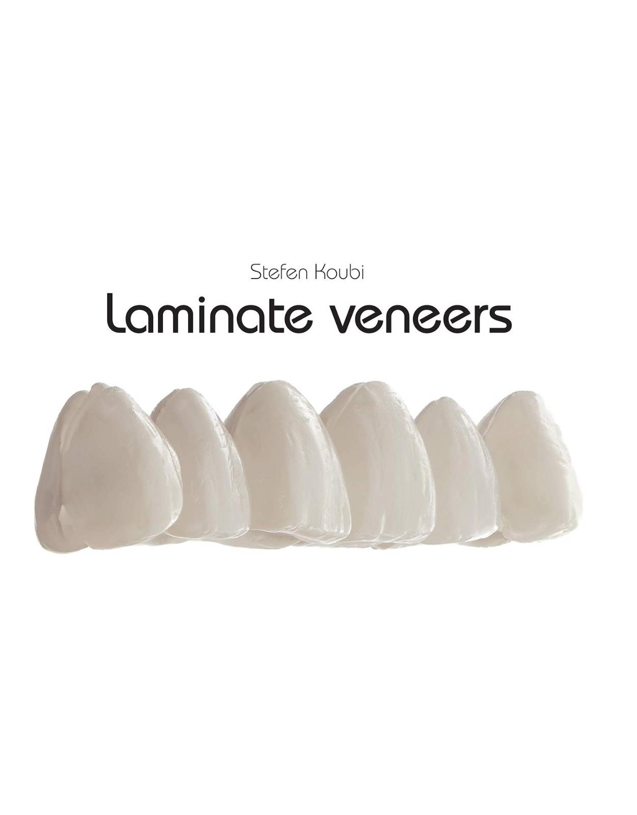 Laminate Veneers: 20 Recipes for Smile Design