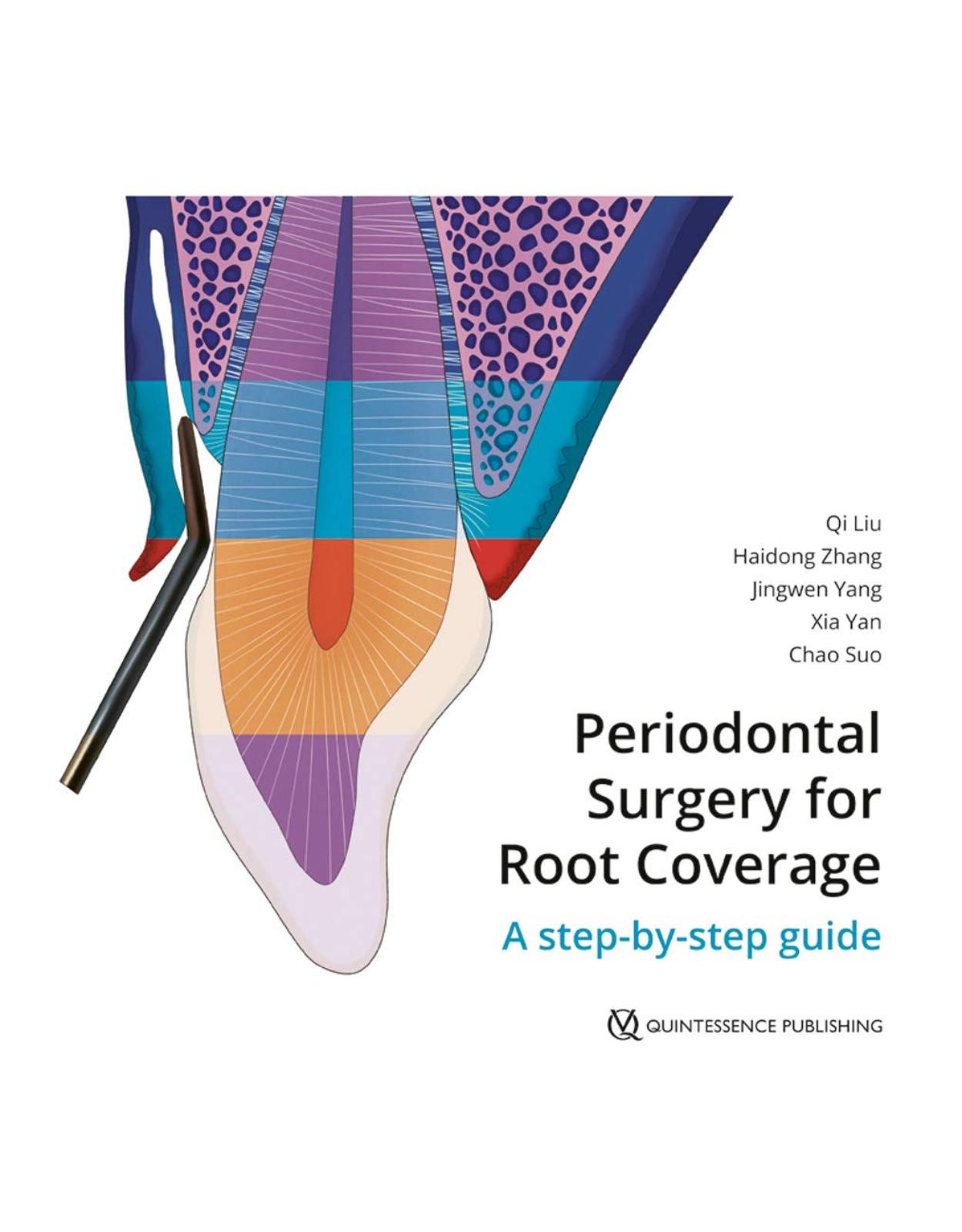 Periodontal Surgery for Root Coverage: A step-by-step guide