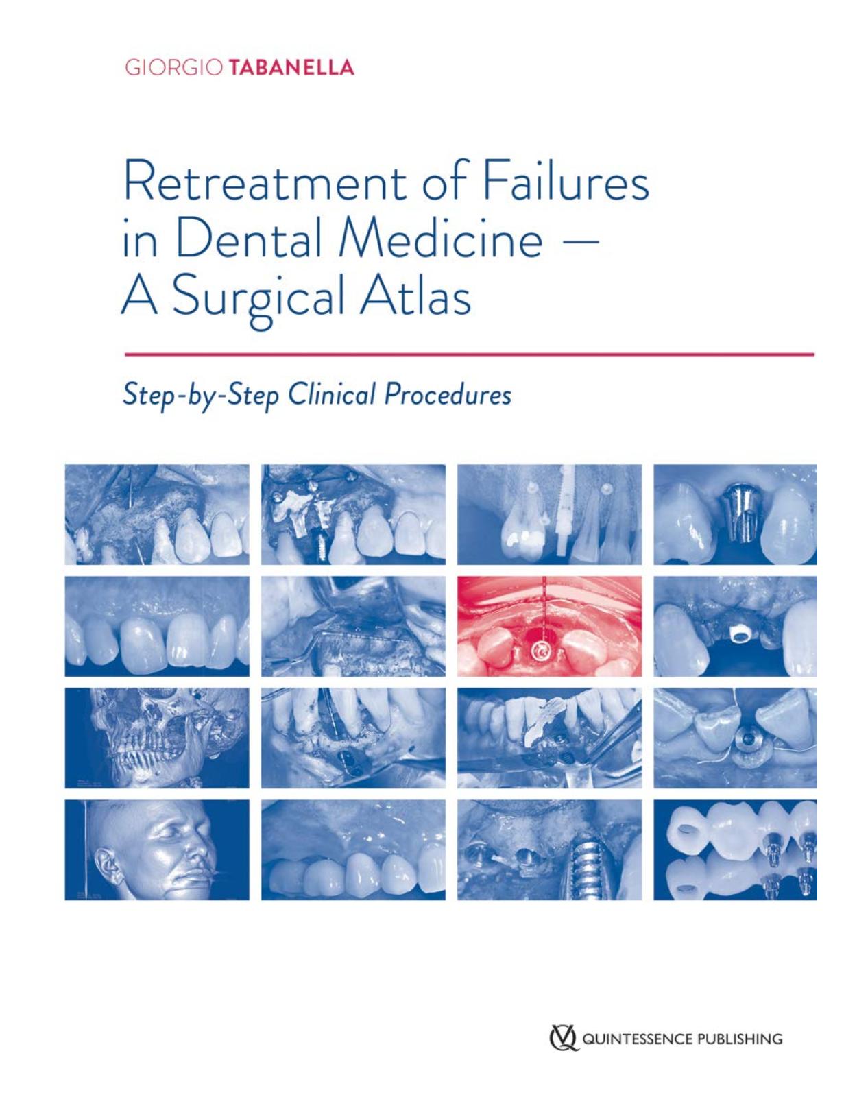 Retreatment of Failures in Dental Medicine - A Surgical Atlas: Step-by-Step Clinical Procedures