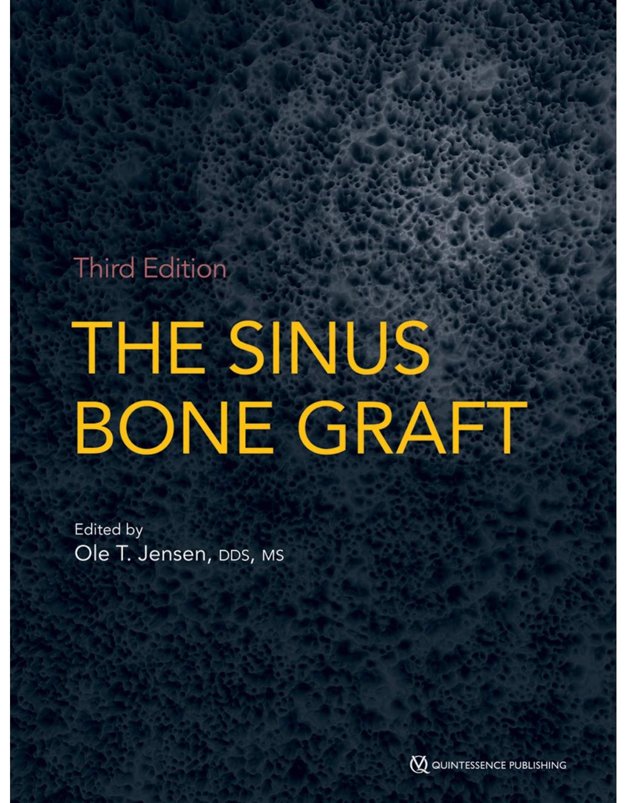 The Sinus Bone Graft