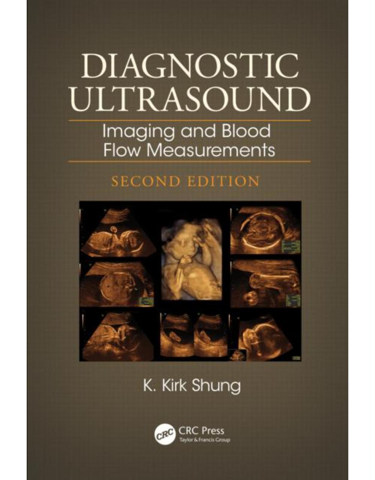 Diagnostic Ultrasound: Imaging and Blood Flow Measurements, Second Edition