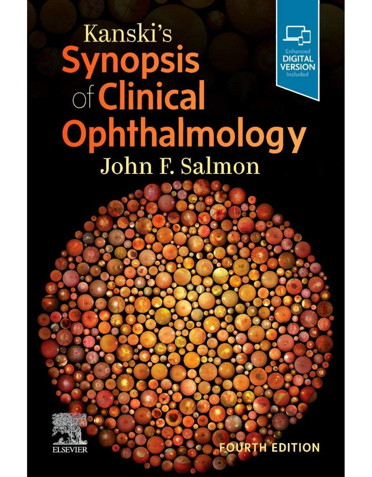 Kanski’s Synopsis of Clinical Ophthalmology 