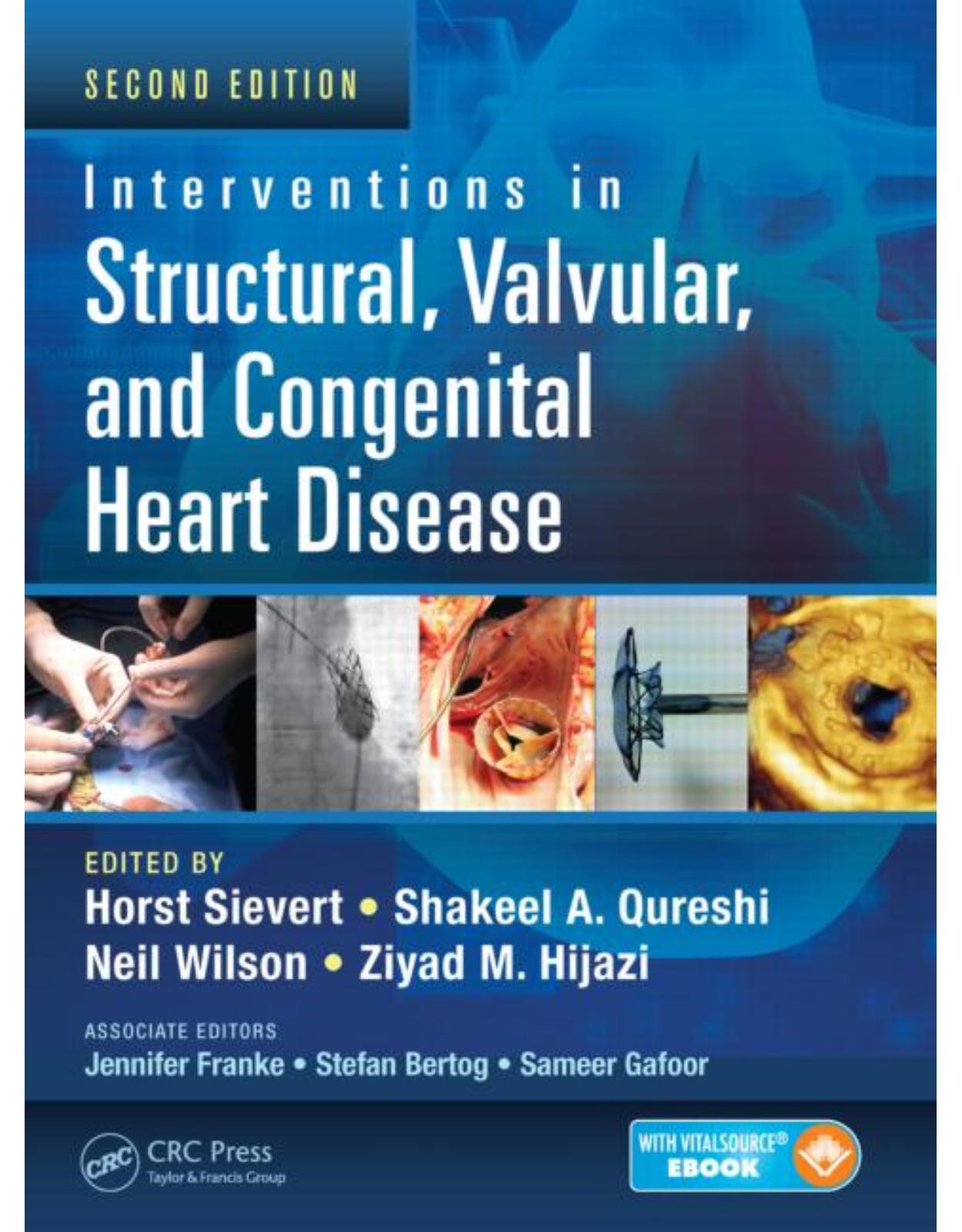 Interventions in Structural, Valvular and Congenital Heart Disease, Second Edition