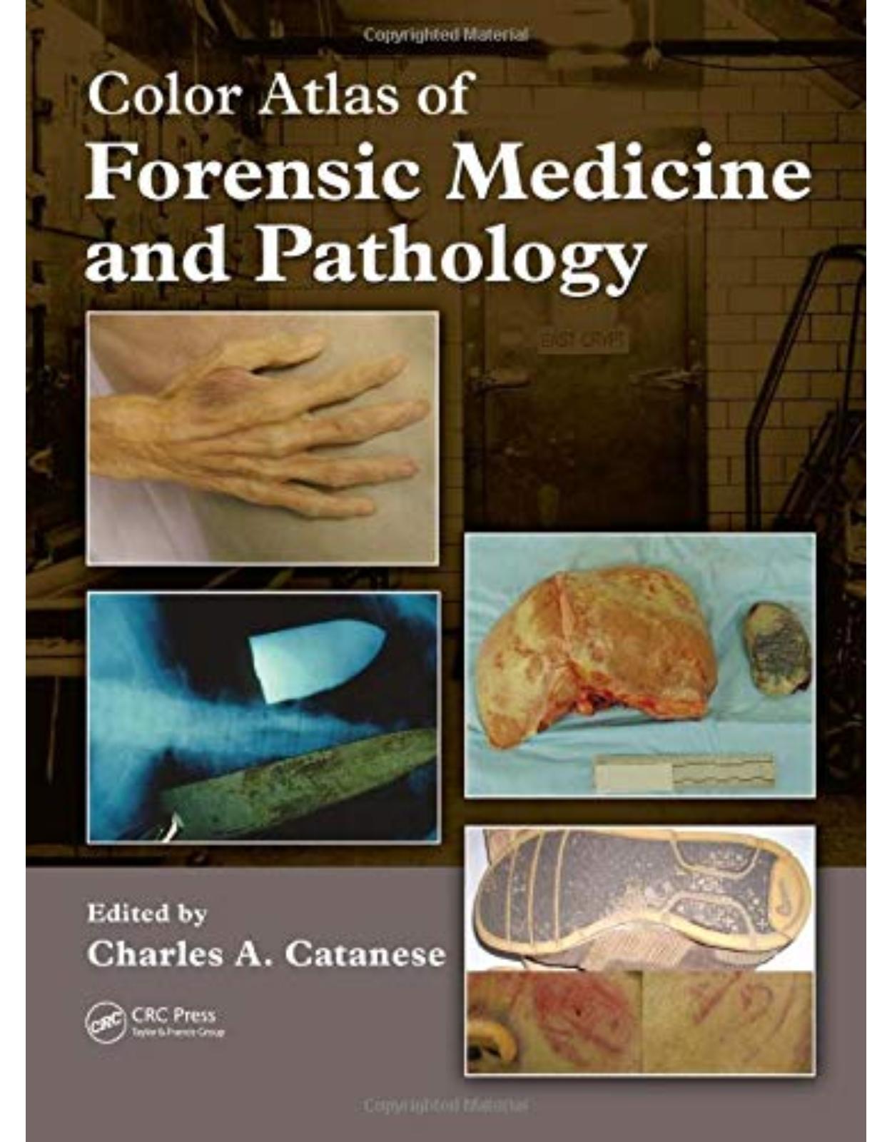 Color Atlas of Forensic Medicine and Pathology 