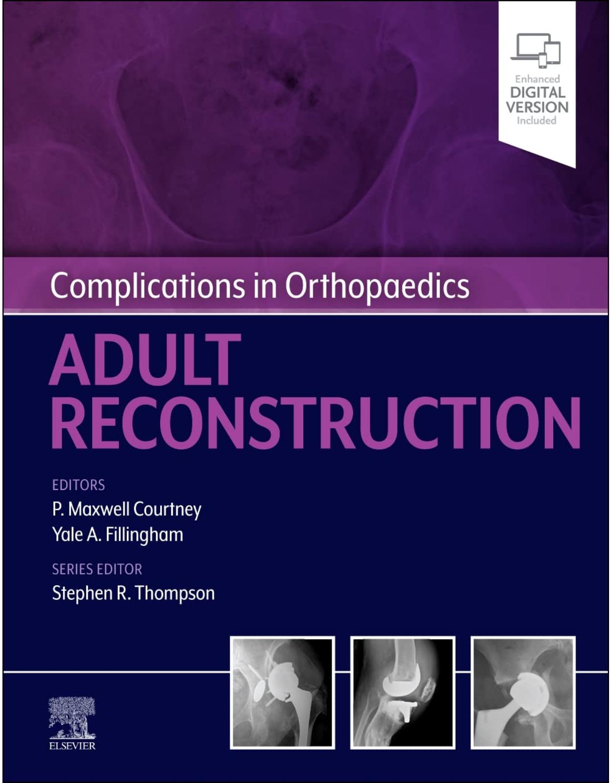 Complications in Orthopaedics: Adult Reconstruction