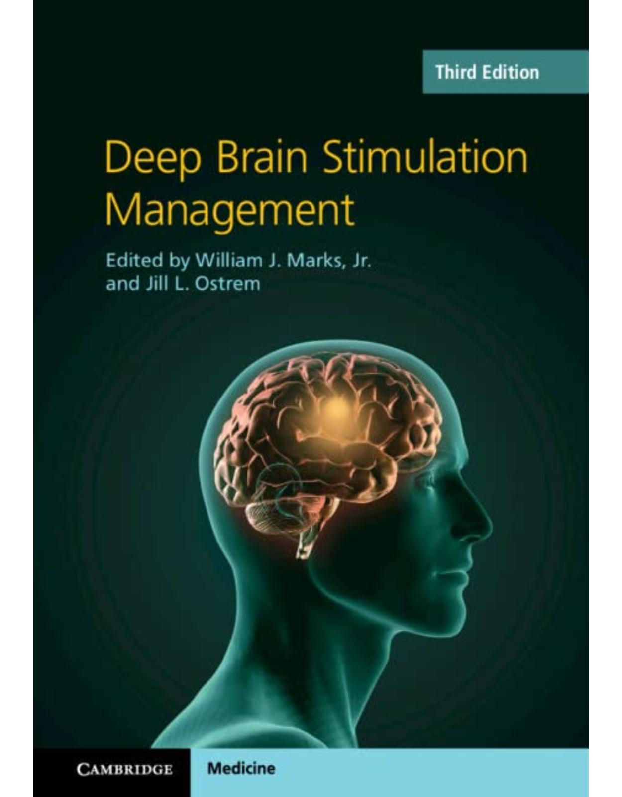 Deep Brain Stimulation Management