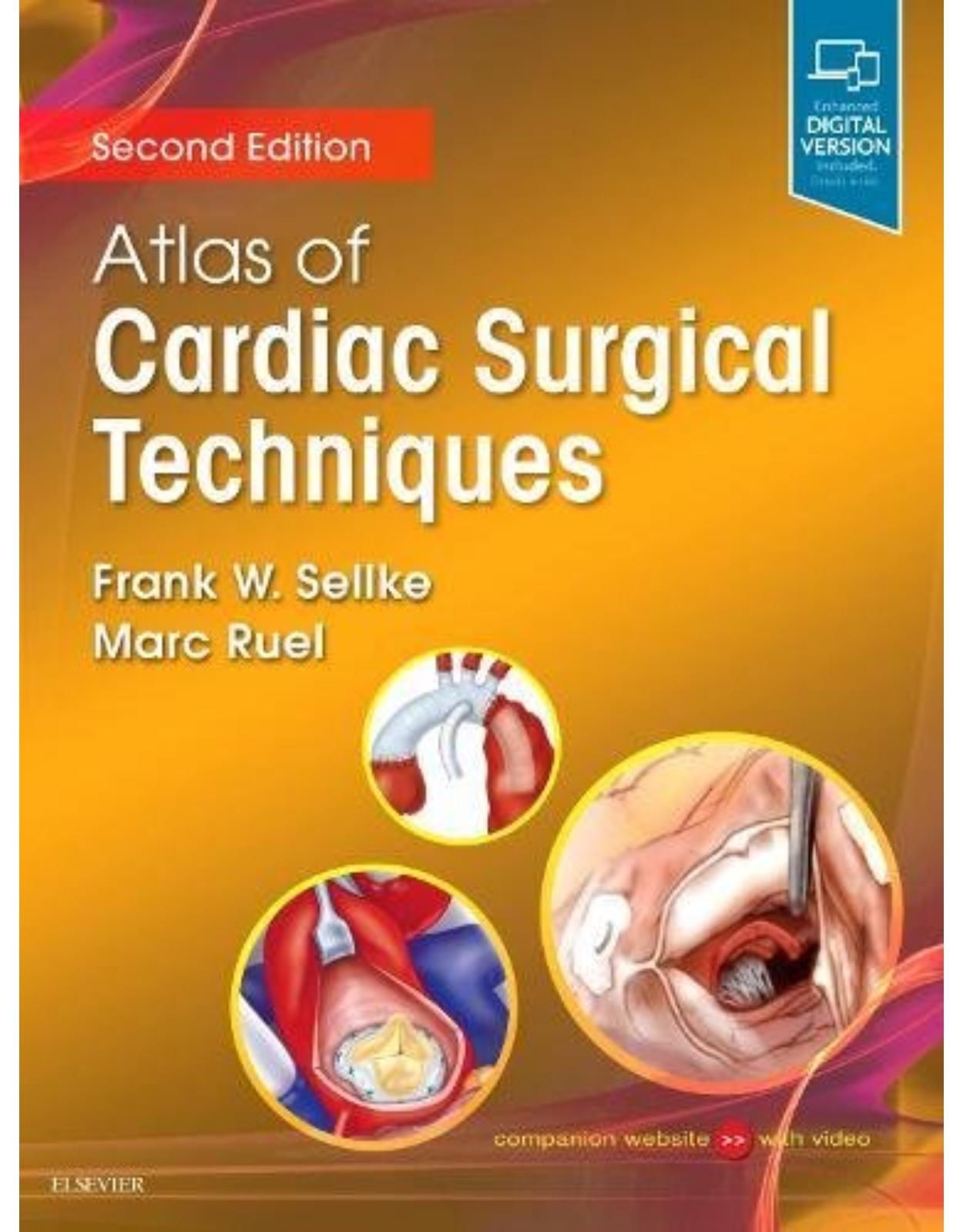 Atlas of Cardiac Surgical Techniques, 2e