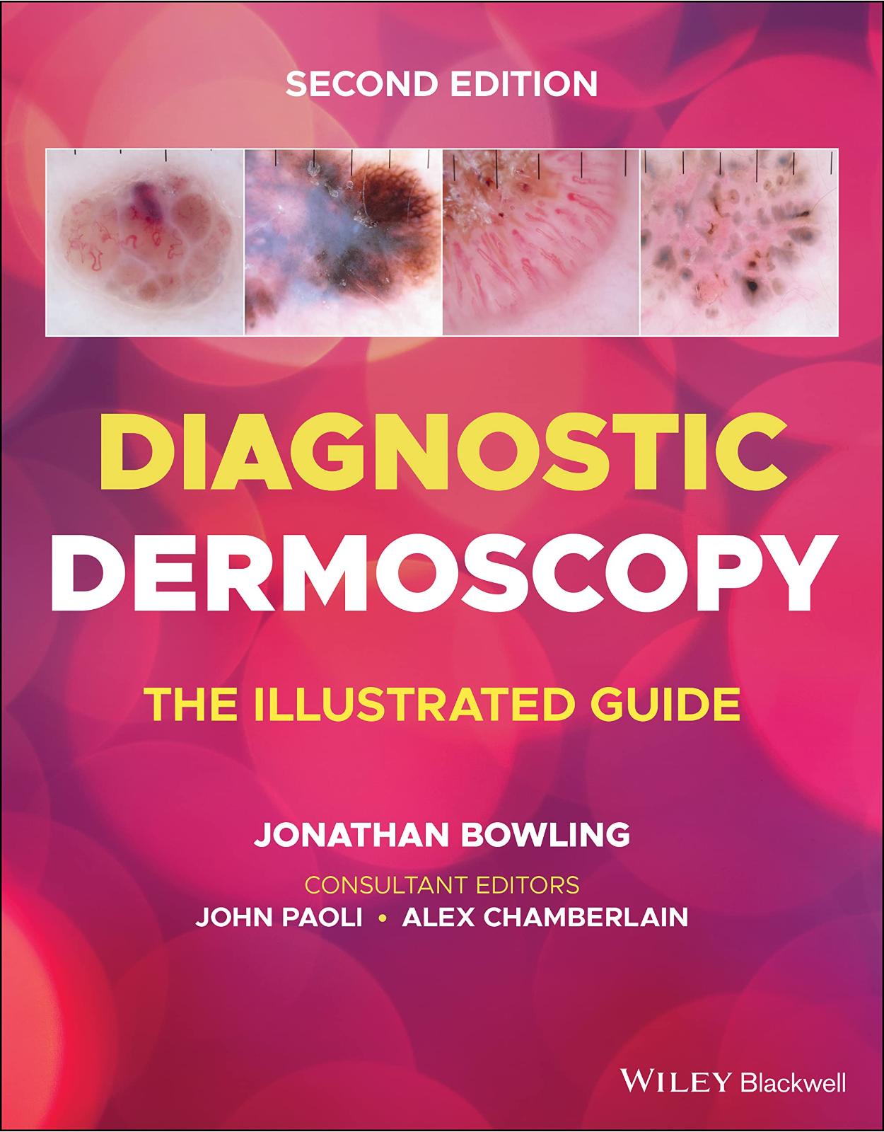 Diagnostic Dermoscopy – The Illustrated Guide, 2e