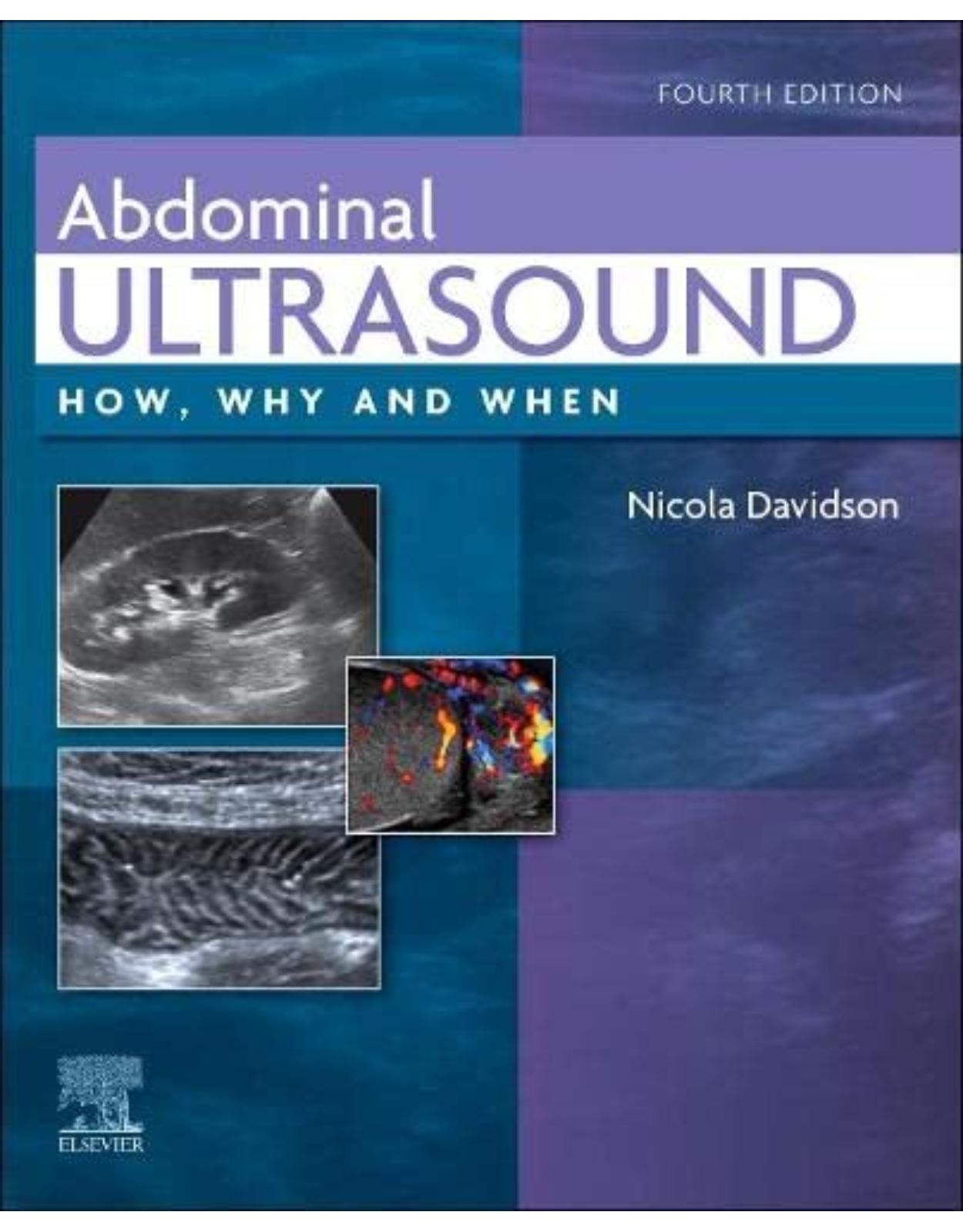 Abdominal Ultrasound: How, Why and When