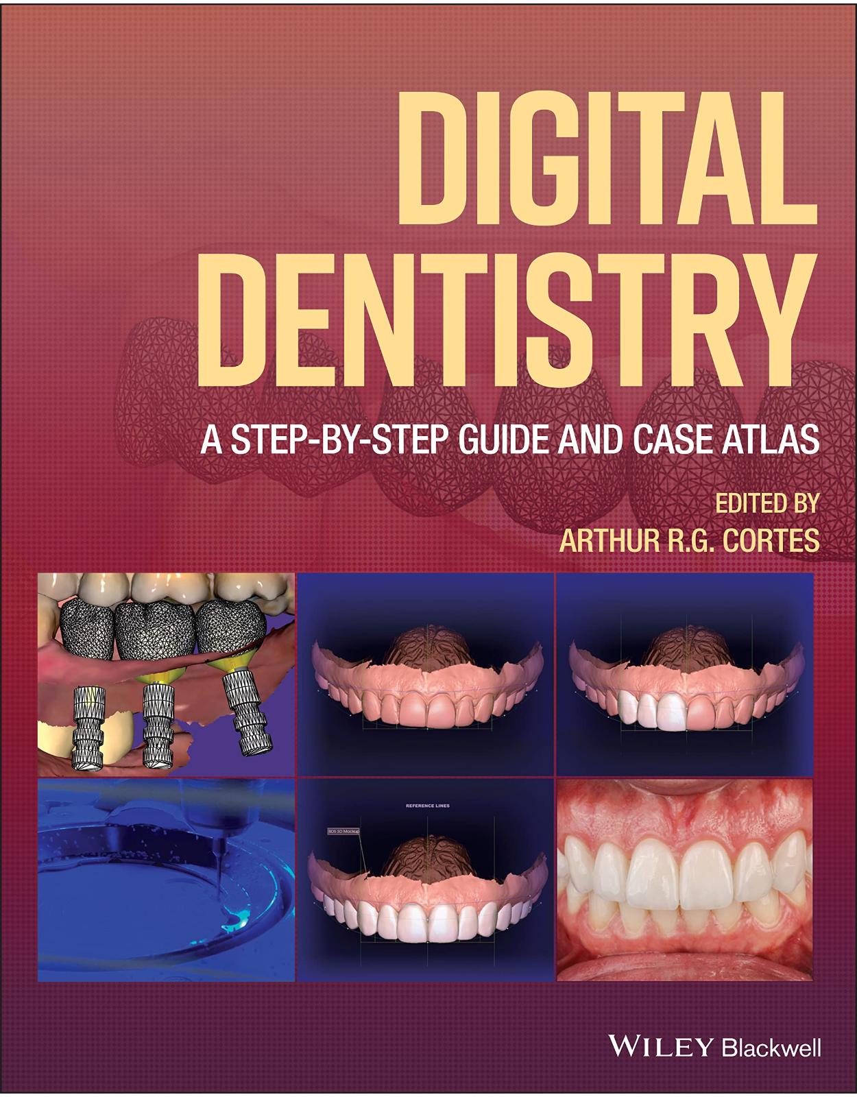 Digital Dentistry: A Step–by–Step Guide and Case Atlas 