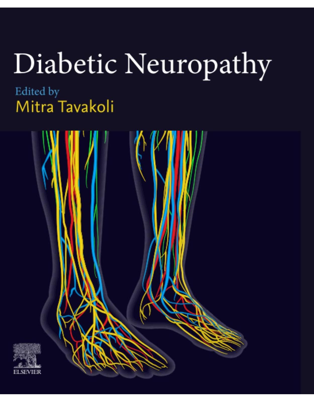 Diabetic Neuropathy