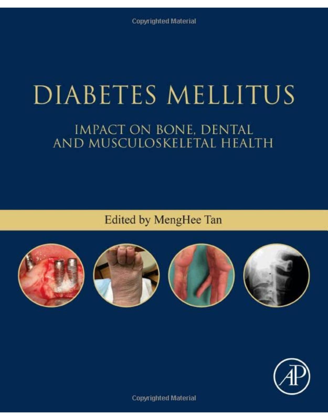 Diabetes Mellitus