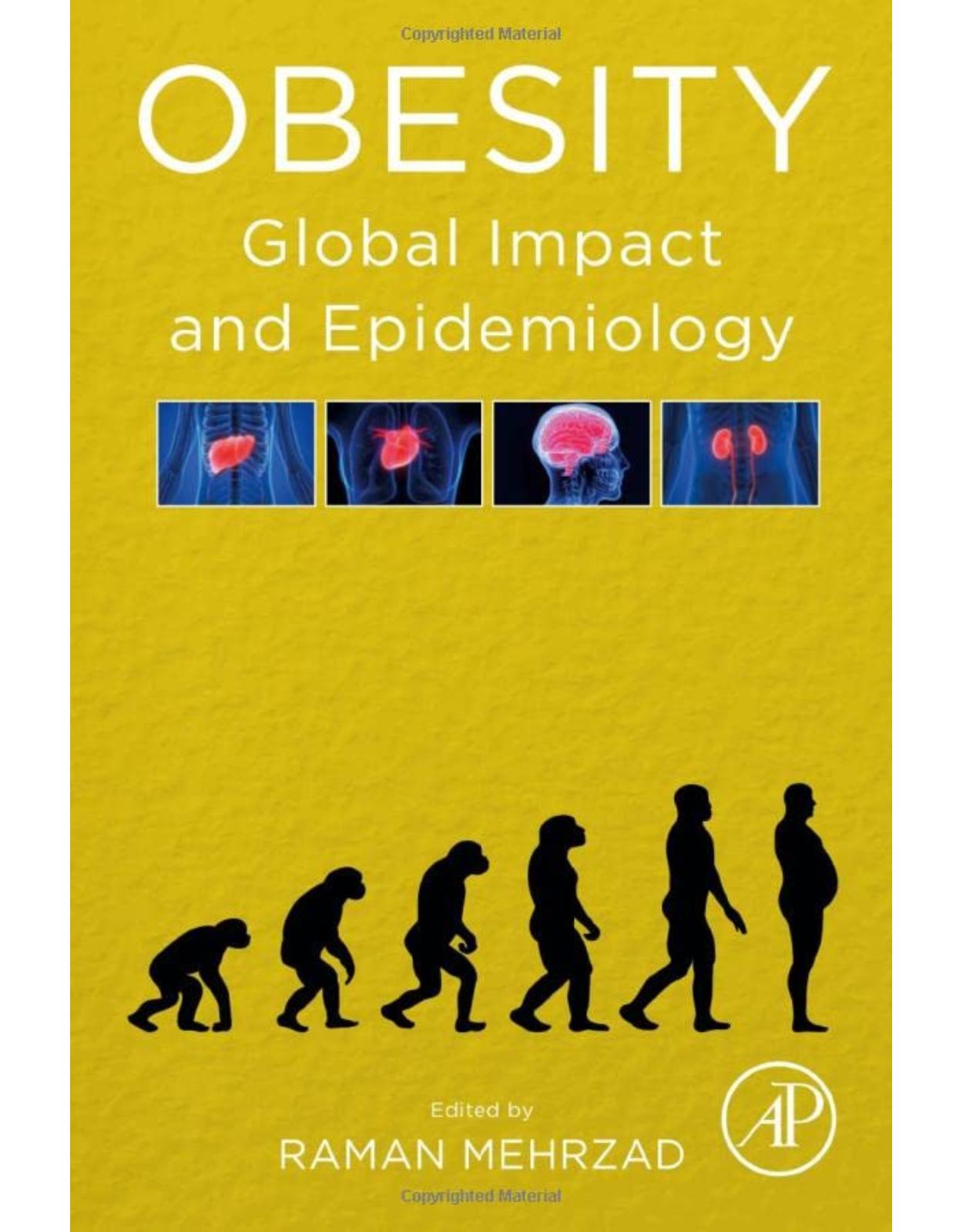 Obesity: Global Impact and Epidemiology 