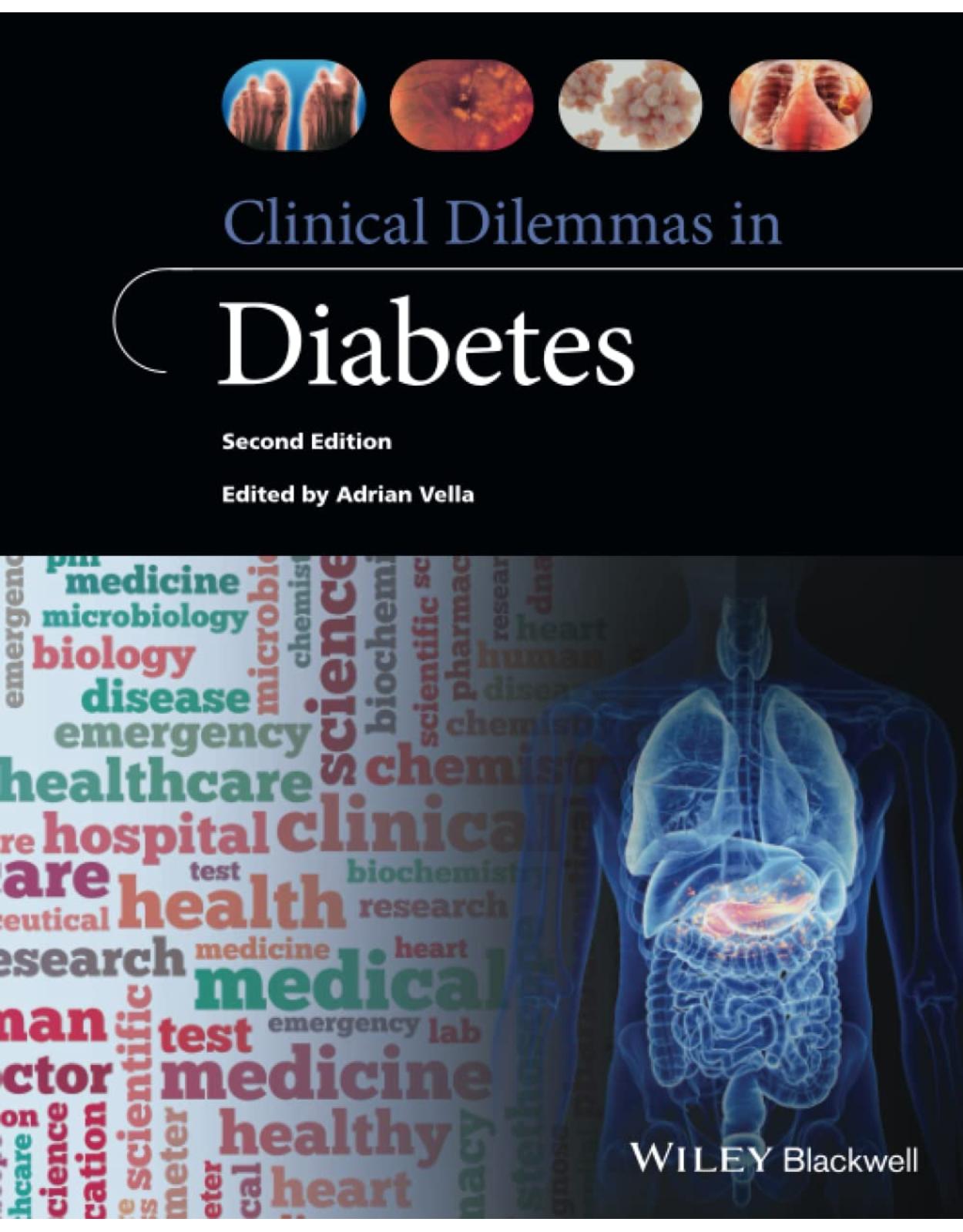 Clinical Dilemmas in Diabetes