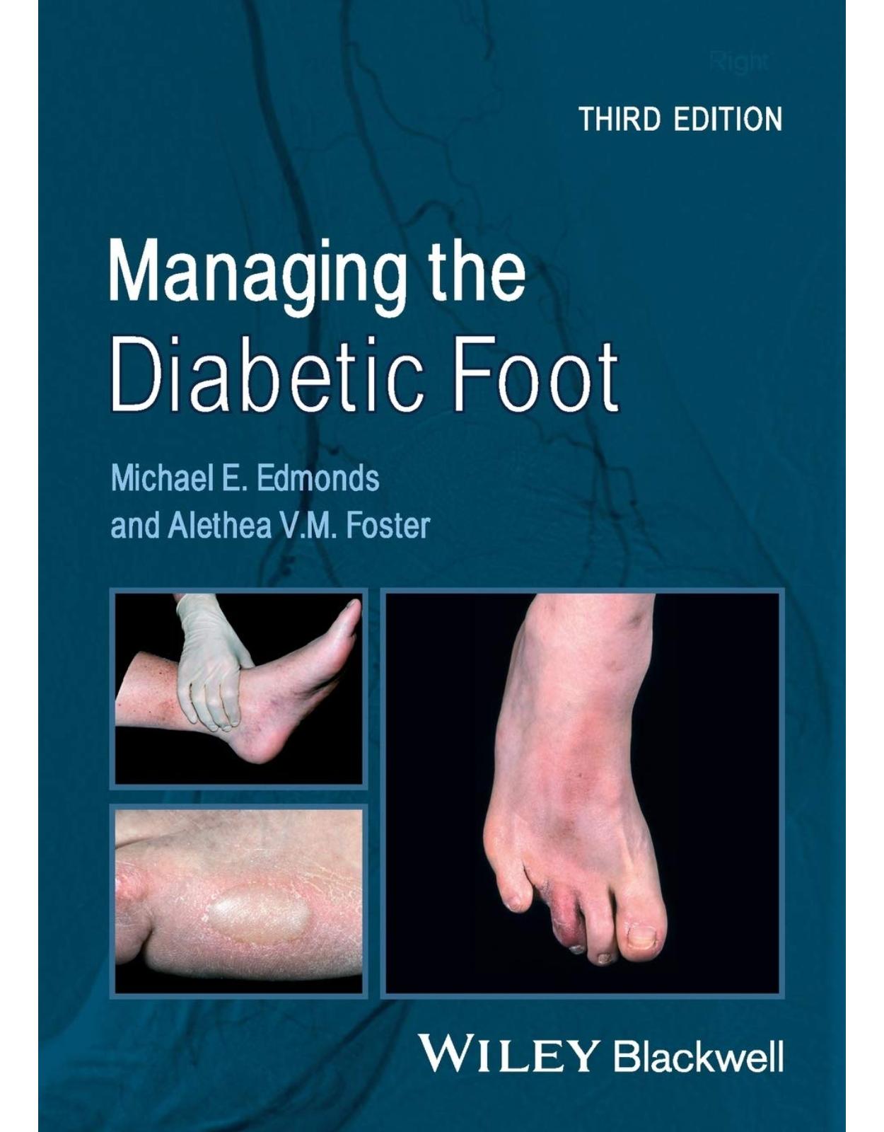 Managing the Diabetic Foot