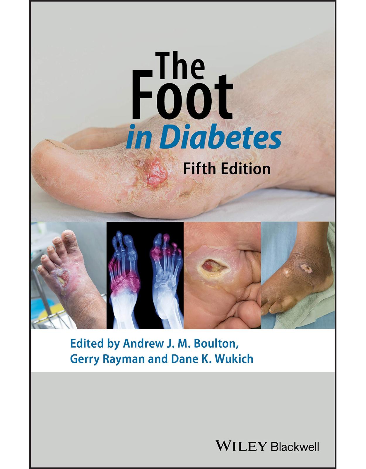 The Foot in Diabetes 