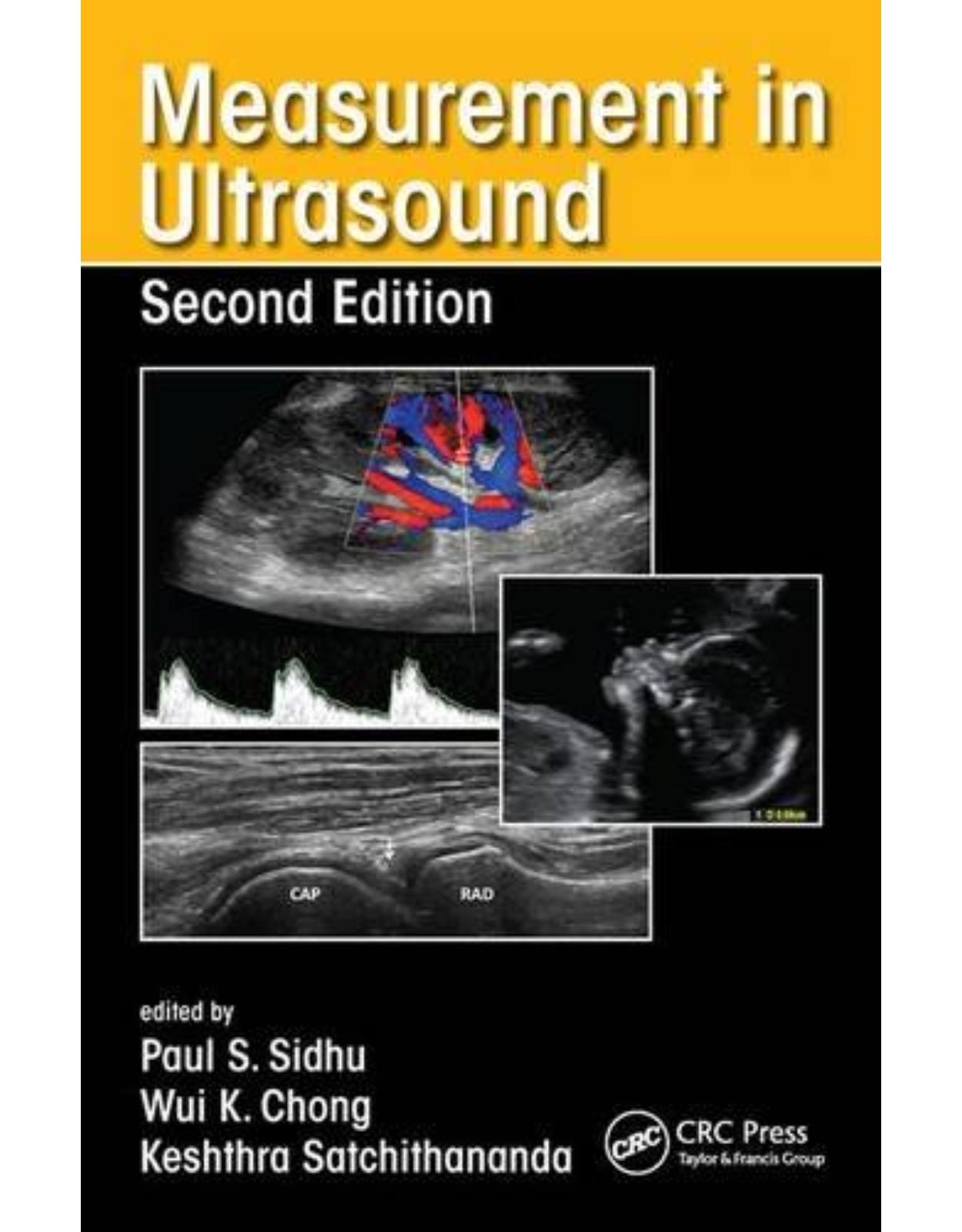 Measurement in Ultrasound, Second Edition