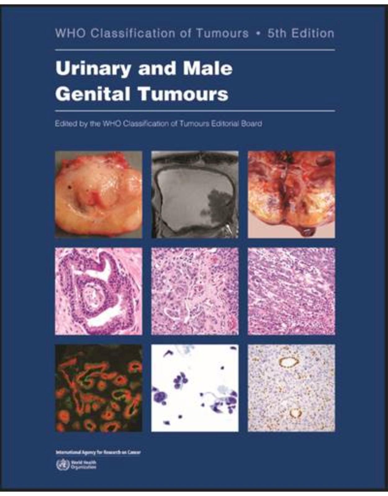 Urinary and Male Genital Tumours