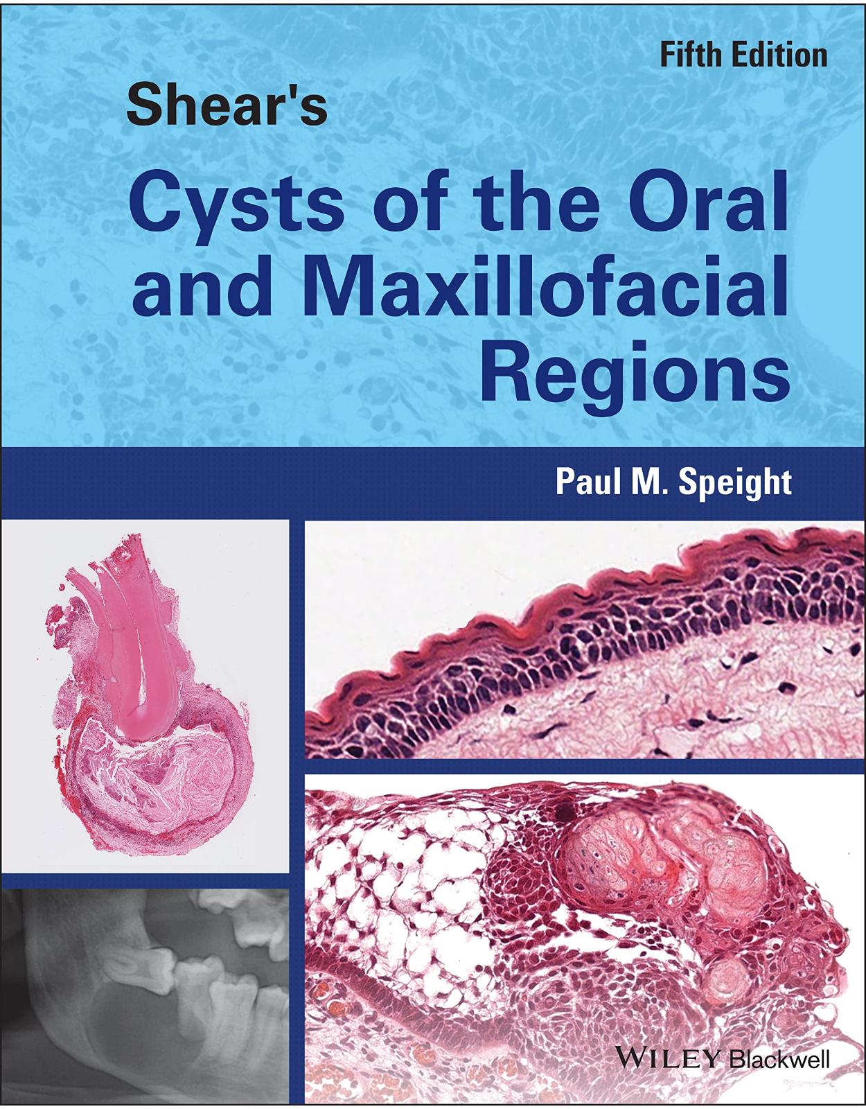 Shear′s Cysts of the Oral and Maxillofacial Region s 5th Edition