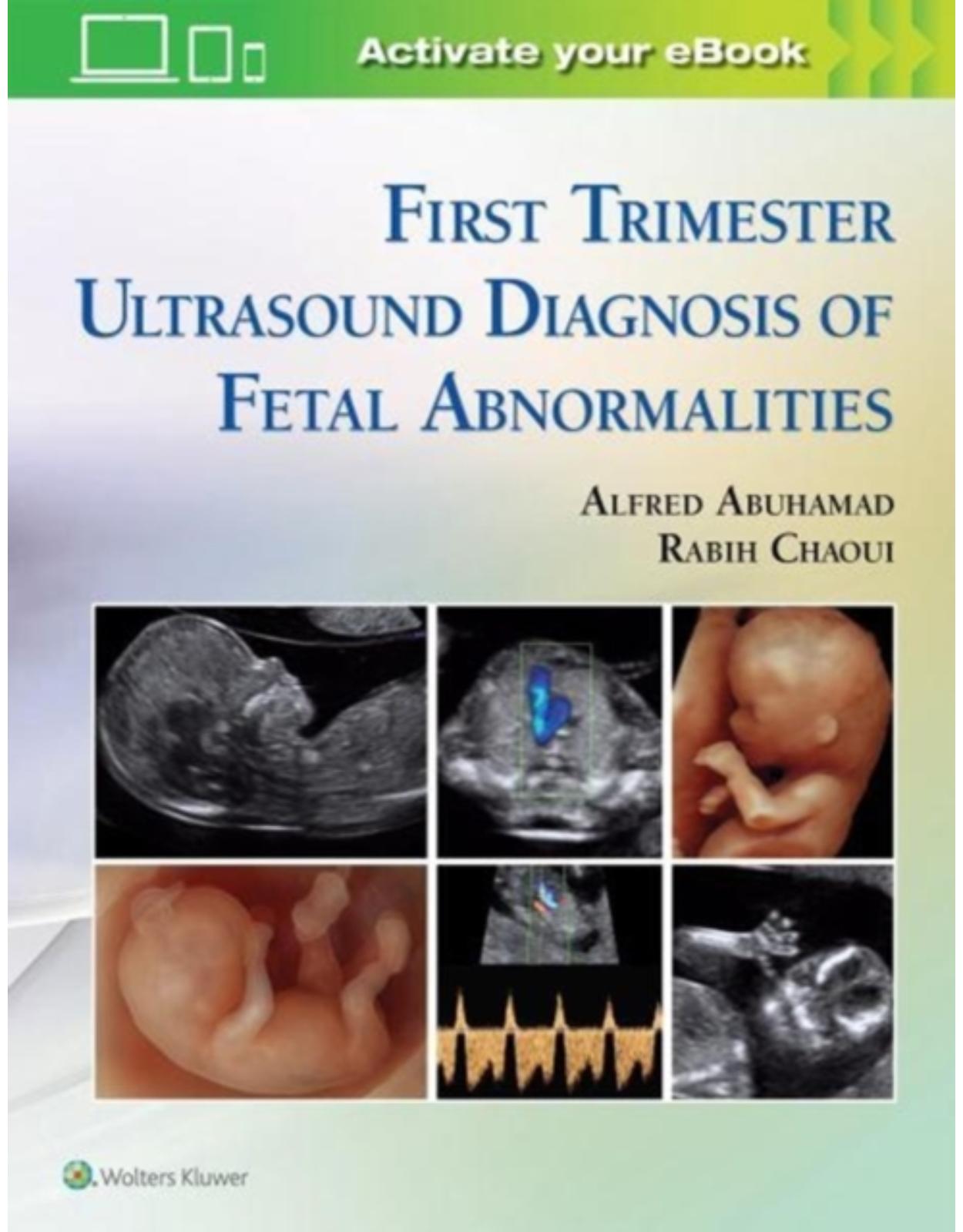 First Trimester Ultrasound Diagnosis of Fetal Abnormalities 