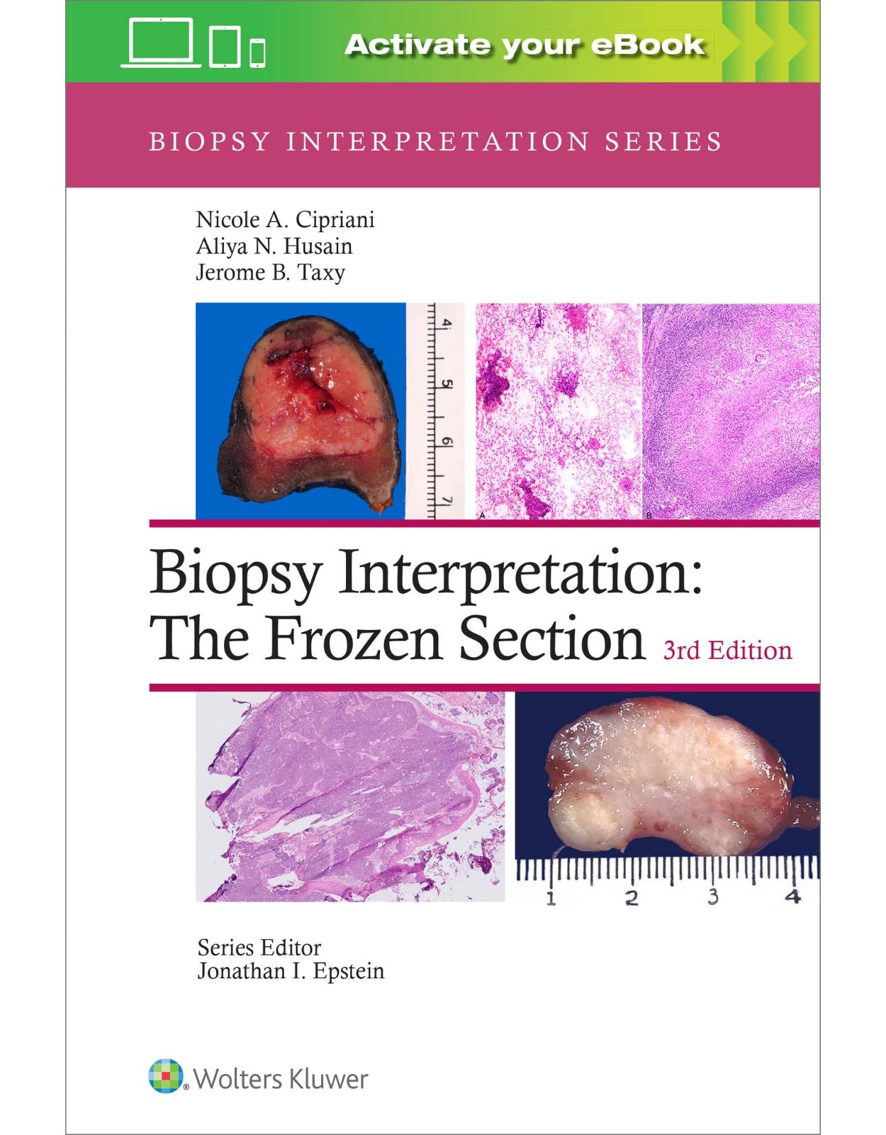 Biopsy Interpretation: The Frozen Section