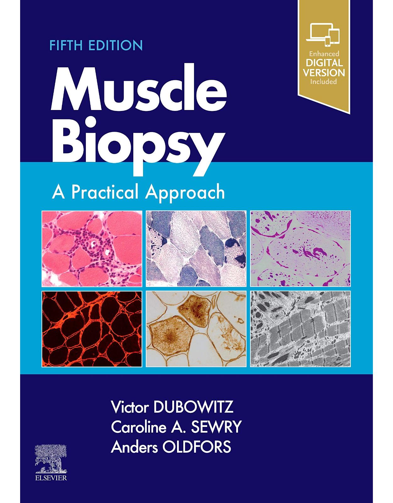 Muscle Biopsy: A Practical Approach